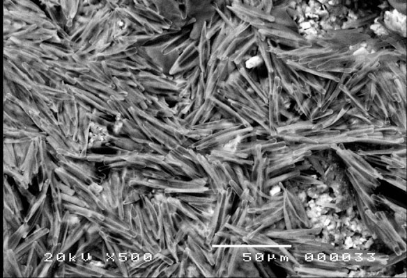 photographie du biofilm en microscopie électronique